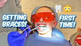 Getting Braces For The First Time! 🦷