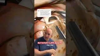When Is Shoulder Surgery Wrong⁉️ #shorts