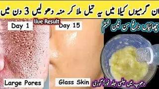 Parmenat Sun Tan Removal within 5 Minute |SunbTan Removal Home Remedy | Pigmentation removal at Home