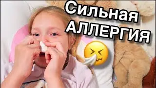 Как НОГА/ Все еще ХОЖУ на Костылях/ У Ксюши  сильная АЛЛЕРГИЯ