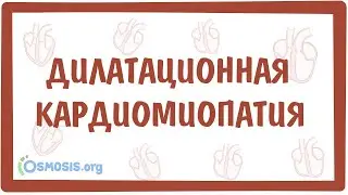 Дилатационная кардиомиопатия — причины, симптомы, патогенез, диагностика, лечение