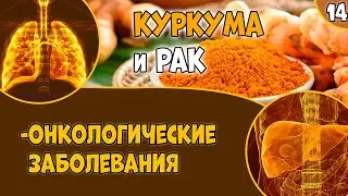 КУРКУМА (видео 14): против рака.