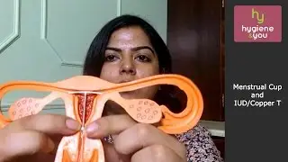 Menstrual Cup and IUD or Copper T #priyankanjain #coppert