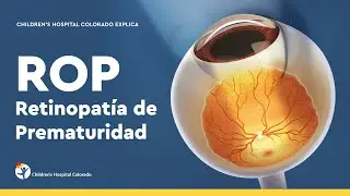 Retinopatía de la prematuridad: diagnóstico y tratamiento