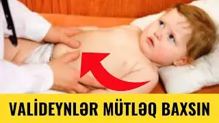 Böyrək Genişlənməsi- Bu Uşaqları ÖMÜRLÜK İzləyə Bilərik