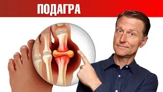 Натуральное и очень действенное средство от подагры 👍