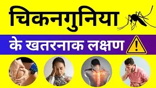 Chikungunya ke Lakshan Kya Hai? Signs & Symptoms of Chickungunya