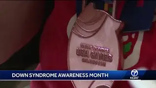 Breaking the barrier: Down Syndrome awareness month
