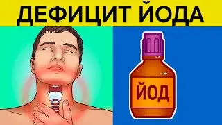 ДЕФИЦИТ ЙОДА в организме. ЧТО ТВОРИТ недостаток ЙОДА с организмом! Продукты от дефицита йода!