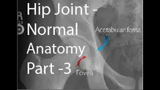 HIp Joint - Part 3 -- Normal Hip Anatomy