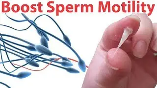 Foods To Increase Male Fertility | Solution Of Male Infertility | Ways To Increase Male Fertility