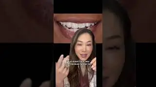 Do you have translucent teeth? This video is for you. #teethwhitening #clearteeth #translucentteeth