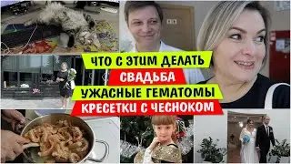 Что с ЭТИМ ДЕЛАТЬ / СВАДЬБА / Ужасные ГЕМАТОМЫ / Креветки с ЧЕСНОКОМ / Как приготовить Креветки /