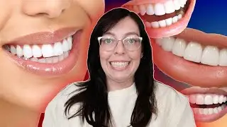 veneers are not a sidehustle