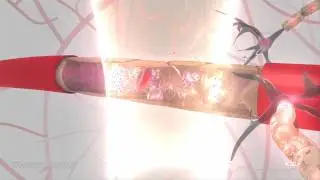 Elisa Konofagou - Blood Brain Barrier Animation
