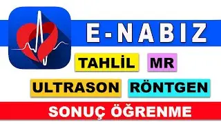 ✅ e Nabız TAHLİL ✅ ULTRASON ✅ RÖNTGEN ✅ TOMOGRAFİ ve ✅ MR Sonucu Öğrenme