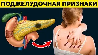 Первые ПРИЗНАКИ проблем с ПОДЖЕЛУДОЧНОЙ. Какие продукты любит ПОДЖЕЛУДОЧНАЯ ЖЕЛЕЗА?