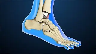 Total Ankle Replacement Surgery | Nucleus Health