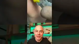 Doctor reacts to extremely satisfying and RIDICULOUS splinter removal! 