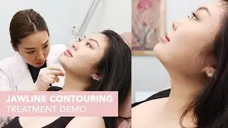 Jawline Contouring (Chin + Jawline Fillers) with Nurse Angella