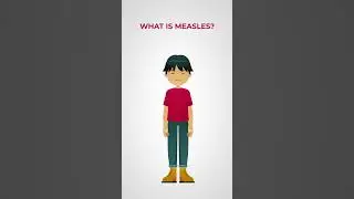 What's the deal with measles?