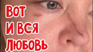 🔴 Ну как теперь на публику ТО????  