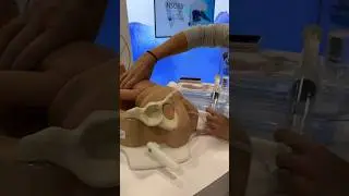Did you have a fetal pillow for your c-section? #csection #csectionrecovery #givingbirth #birthprep