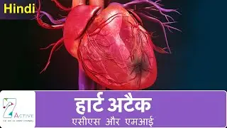 हार्ट अटैक (एसीएस और एमआई) | Heart Attack (ACS & MI) | Hindi