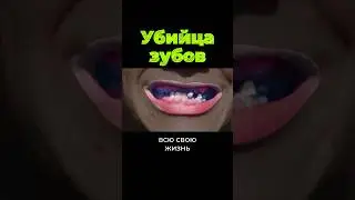 Кто убивaет наши зубы? 