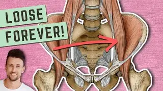 How to Permanently Loosen a Tight Psoas (Hidden Cause Explained!)