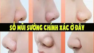 5 Tướng Mũi Quý Hơn Vàng Quyết Định Cuộc Đời Vận Mệnh Giàu Sang Phú Quý