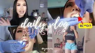 COME TO MY DENTIST APPT WITH ME VLOG :) | how i get my teeth cleaning + polishing with braces on