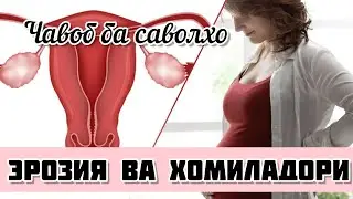 Оё  бо эрозия гарданаки БАЧАДОН ХОМИЛАДОР шудан мумкин аст? 