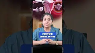 Pregnancy with PCOS 