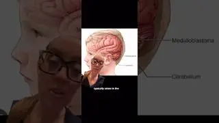 Michael Strahan’s daughter Isabella diagnosed with medulloblastoma- full vid linked above caption ▶️