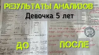 Разбор анализов До и После обращения. Девочка 5 лет