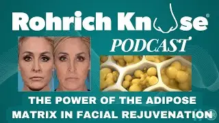 THE POWER OF THE ADIPOSE MATRIX IN FACIAL REJUVENATION