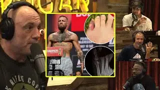 Details On Connor McGregors Injury Ahead Of UFC 303 | Joe Rogan & The Boys