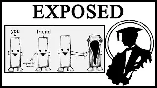 Why Is The Exposed Nerve Prank Horrifying?