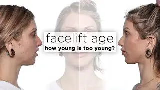 Facelift under 40 years of age? Plastic Surgeon answers FAQs for younger patients pondering facelift