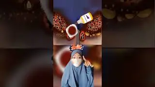 Kompilasi kumpulan Asmr Game perawatan luka infeksi |Mv 