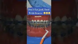 JUNK FOOD with BRACES