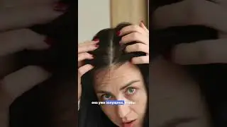 ПЕРХОТЬ Ч. 1/4 - как лечить перхоть, (себорейный дерматит на голове) 
