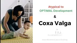 Atypical Development Baby and Coxa Valga & Developmental Delays and Deviations - for Worried Parents