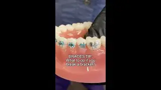 Broken Braces? Here's What To Do... 🦷 