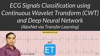ECG Signals Classification using Continuous Wavelet Transform (CWT) and Deep Neural Network