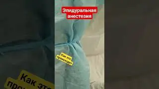 Эпидуральная анестезия