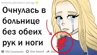 Люди, ПОТЕРЯВШИЕ РУКУ Или НОГУ, Как Это Было?