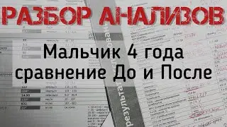 АНАЛИЗЫ РЕБЁНКА ДО И ПОСЛЕ ОБРАЩЕНИЯ КО МНЕ. ОЛЬГА ВЛАДИМИРОВНА КУСТОВА