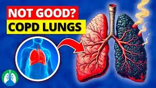 Will My Lungs Heal From COPD If I Quit Smoking?